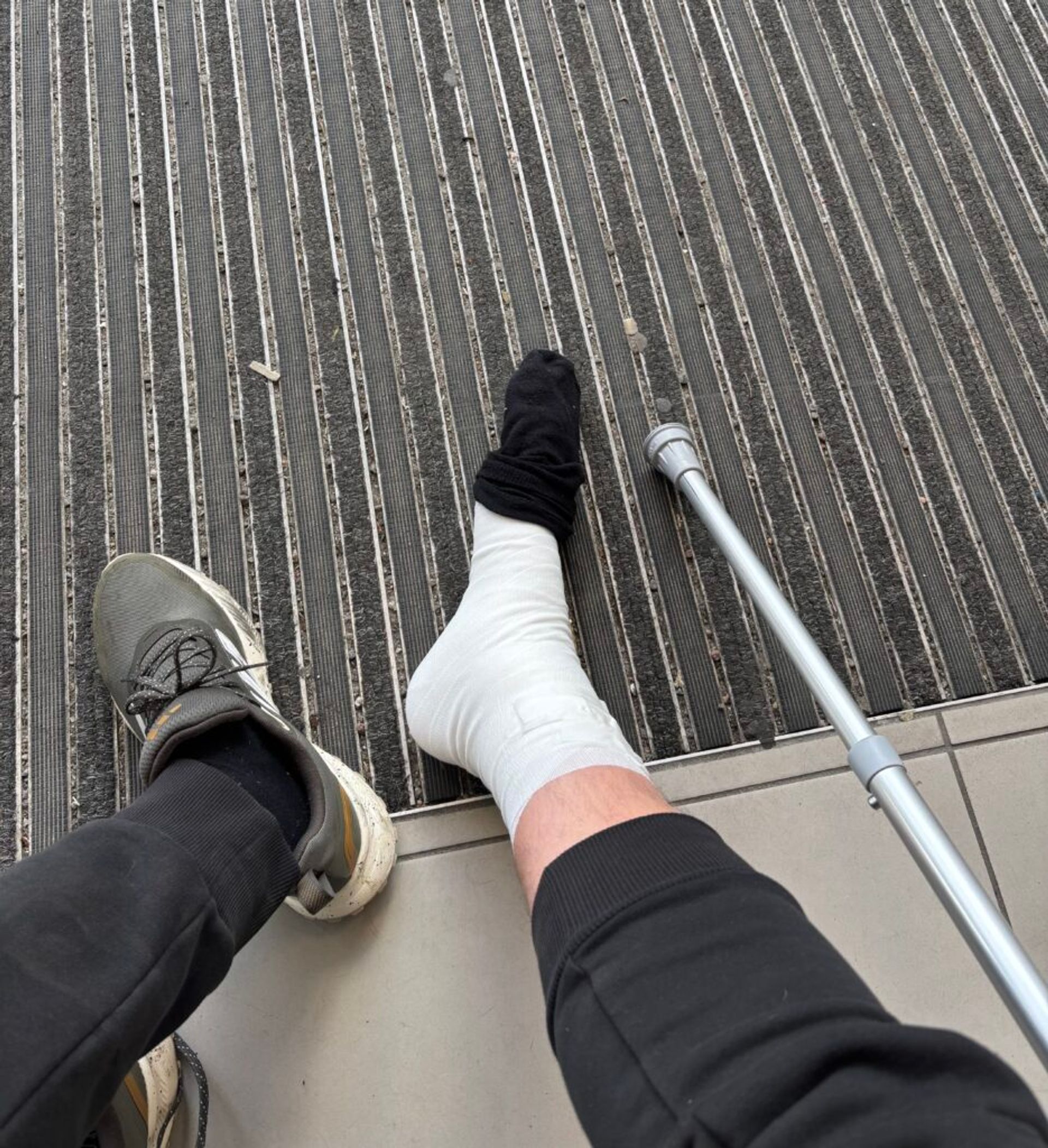 Broken foot in a bandage and healthy foot in a sneaker.