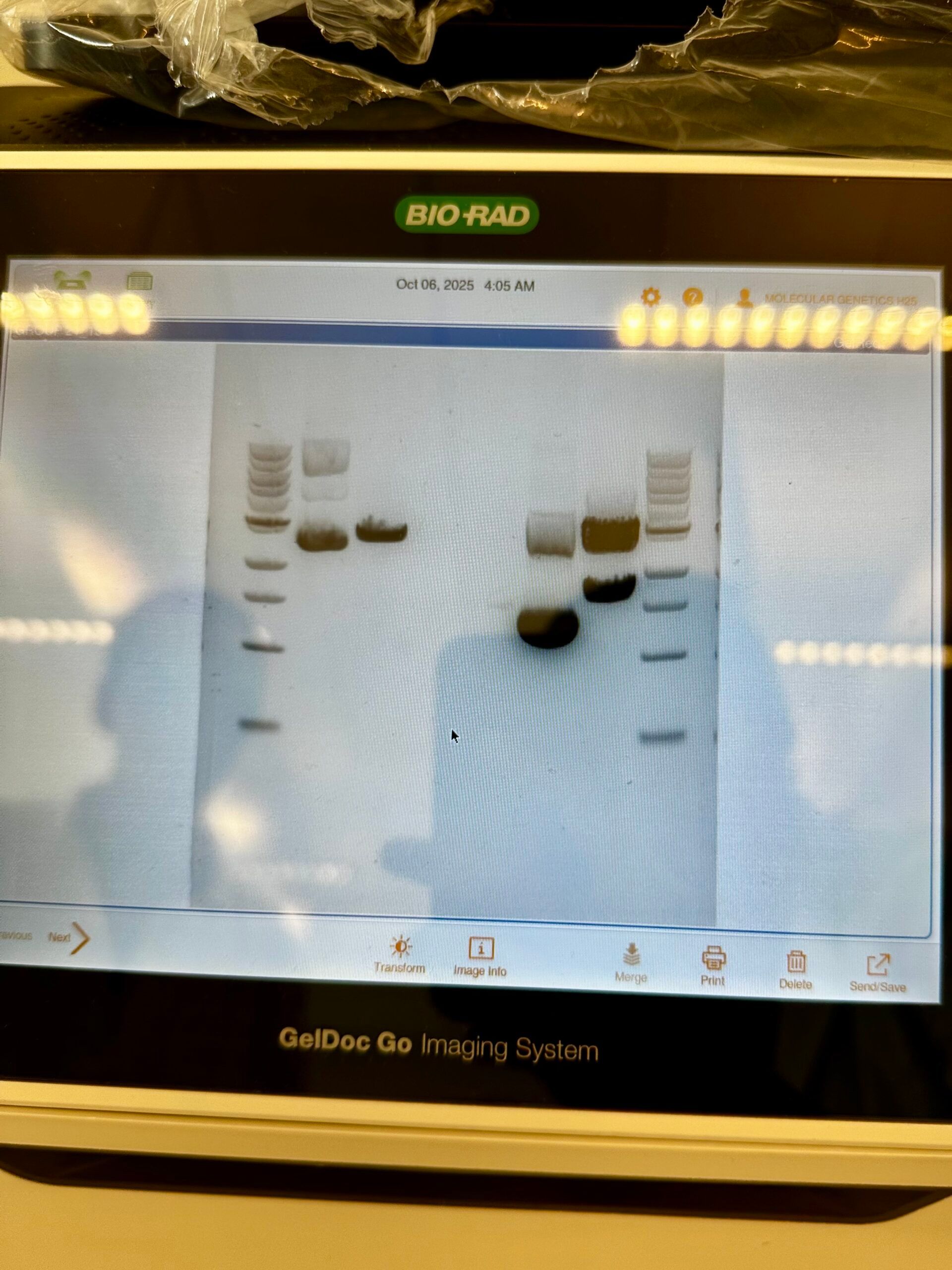 A photograph of a gel electrophoresis output under UV light